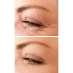 No.1 Lift Augencreme 15 ml