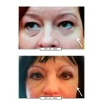 No.1 Lift Augencreme 15 ml