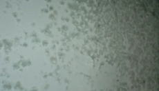 Effektive Methoden zur Bekämpfung von Schimmel an der Wand