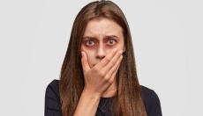 Wie man mit bewährten natürlichen Methoden gegen Blutergüsse vorgeht